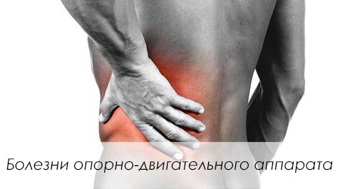 Заболевания опорно-двигательного аппарата