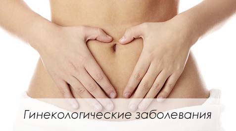 Гинекологические заболевания