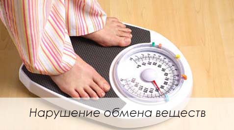 Заболевания обмена веществ