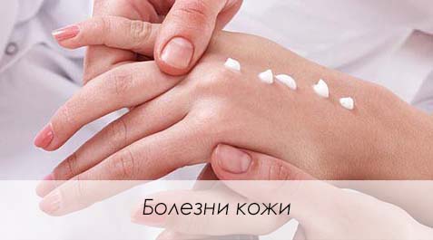 Заболевания кожи